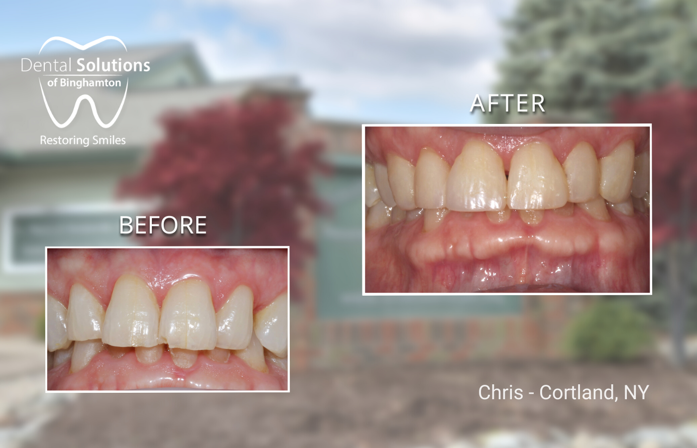 Chris - Cortland, NY